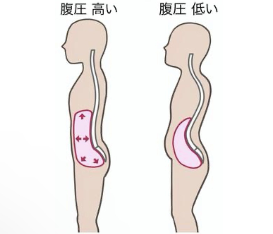 腹圧が抜けている図